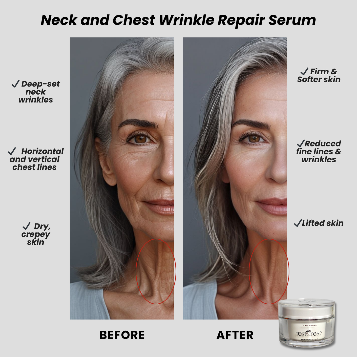 Restore 92 All-natural Neck and Chest Wrinkle Repair